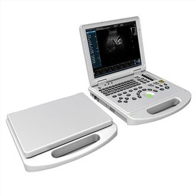 4D Color Doppler Ultrasound Scanner