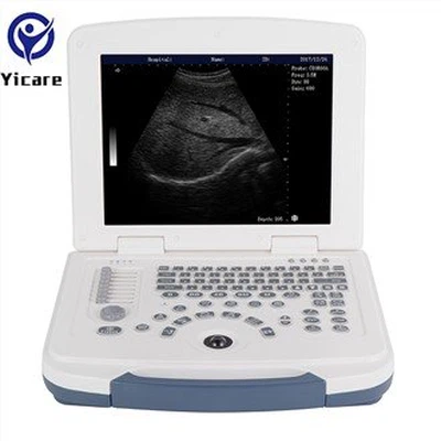 Basic Laptop Ultrasound Biagnostic System