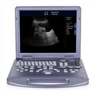 PC Platform Full-digital Ultrasound Diagnostic System