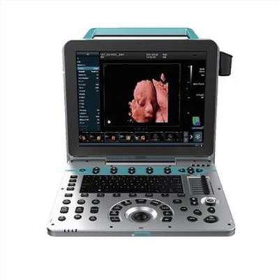 Portable Color Doppler Ultrasound Scanner