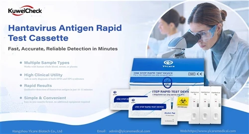 When Every Hour Matters: Early Detection Of Hantavirus Can Make A Difference